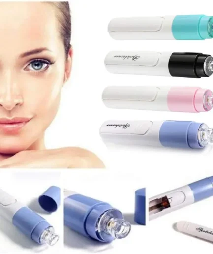 New Electric Blackhead Remover Sucker Black Head Pimple Pore Cleaner Vacuum Blackhead Remover Pore Cleaner (Random color)